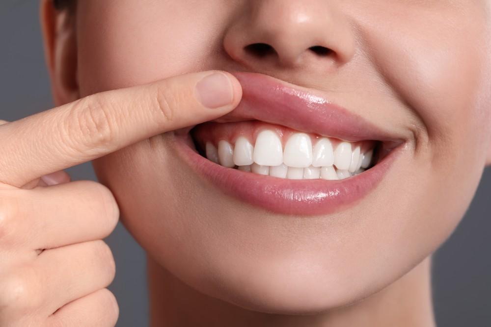 Dental Care